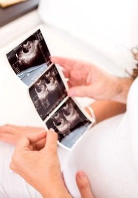 3d / 4D Photos provided in all our ultrasound packages!