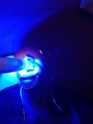 Getting my teeth whitened happy and pleased five Shades different than when I went in good customer service I will be back thank you again