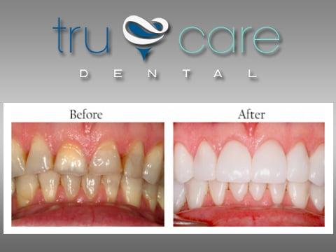 Cosmetic Dentistry Albuquerque, NM