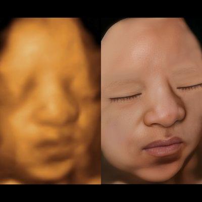 Sneak A Peek Ultrasounds