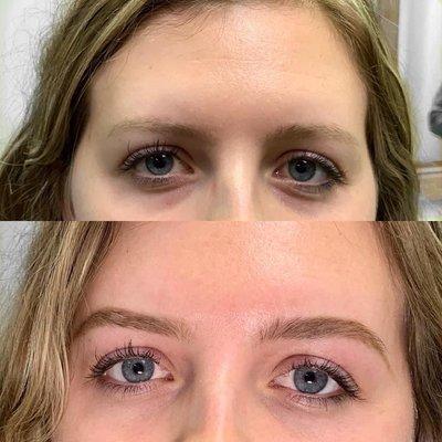 Brow Transformation