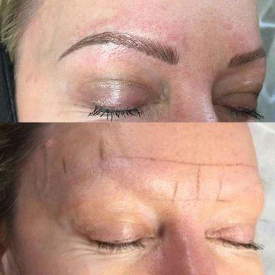 Microblading for eyebrows