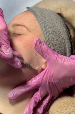 Dermaplane facial