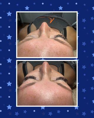 Individual lash extensions