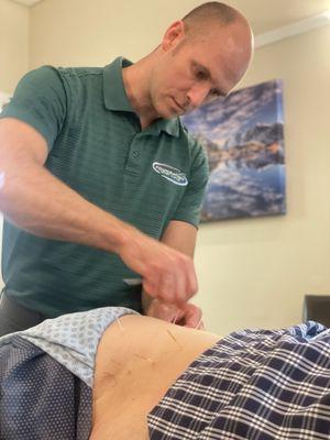 Dry Needling a patient with hip and pelvic pain, before hooking up electric stimulation.