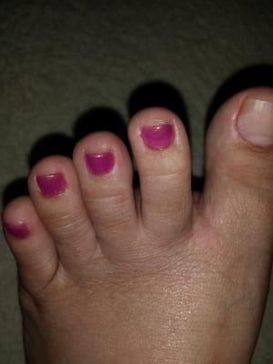 Nail polished came off my big toe and remnant polish around my toes.