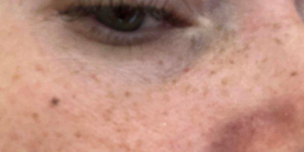 Real Artistic Freckles