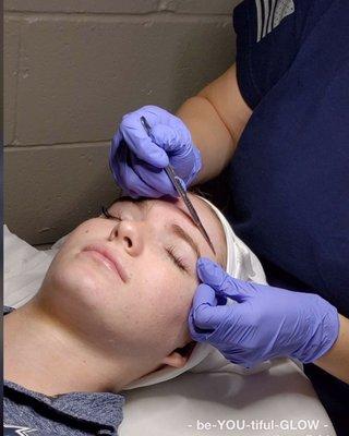 Dermaplaning