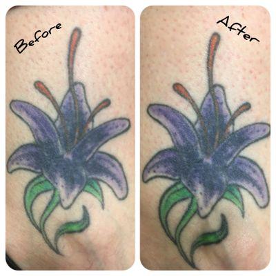 Tattoo Sugaring.  Deep exfoliation of the tattooed area causing the ink to be rejuvenated.