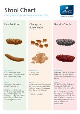 Colon Hydrotherapy treatments help produce healthy stool.