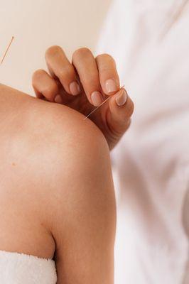 Acupuncture for shoulder pain