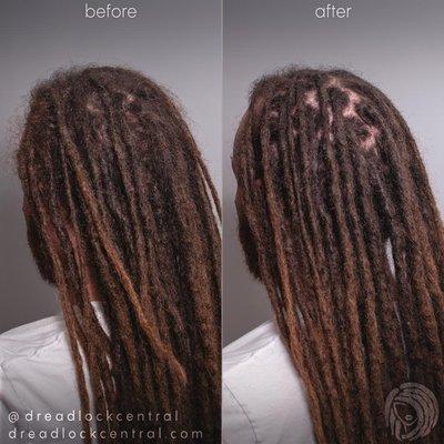 Caucasian Dreadlock Maintenance via Crochet Method