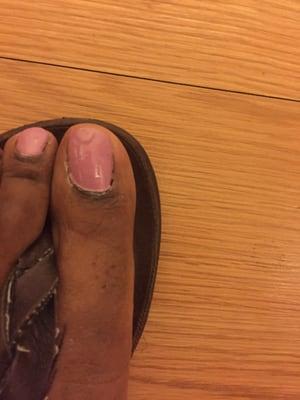 Both big toes are smeared.