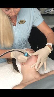 Microdermabrasion