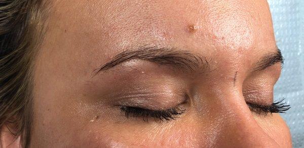 Right side before microblading