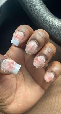 My broken nails