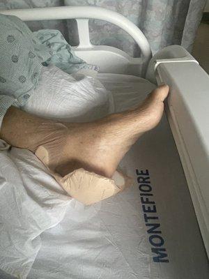 The hospital put this on his foot and never told us why ? What it's for?