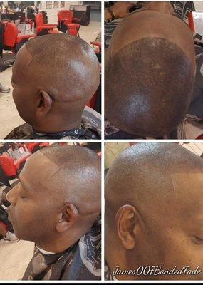 High bald Fade