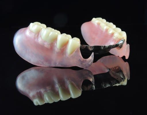 Valplast over a rigid Vitallium frame from Udell Dental Laboratory.