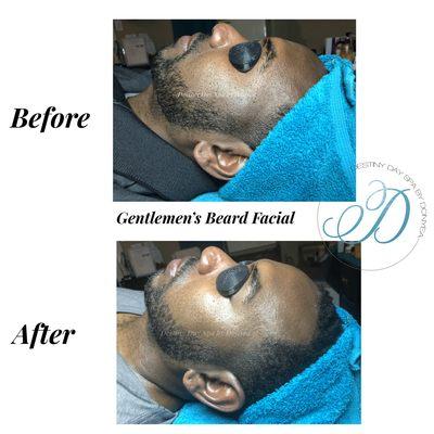 Gentleman's Beard Facial