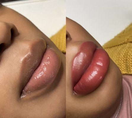 Lip Neutralization