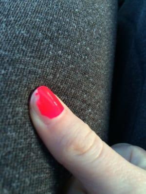 After the first day this was my thumb nail! My other nails were similar. I was very careful about them too!