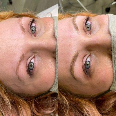 Microblading