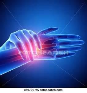 Carpal Tunnel Therapy