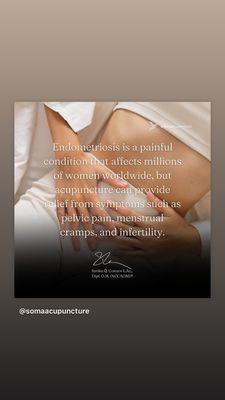 Acupuncture for Endometriosis