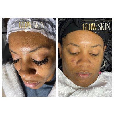 The Glow Skin Spa