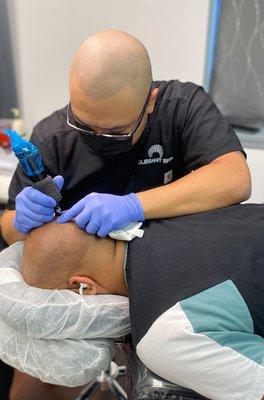 Giving a hair tattoo or scalp micropigmentation to a balding client in Buffalo, NY.