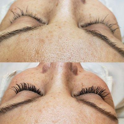 Eyelash extensions