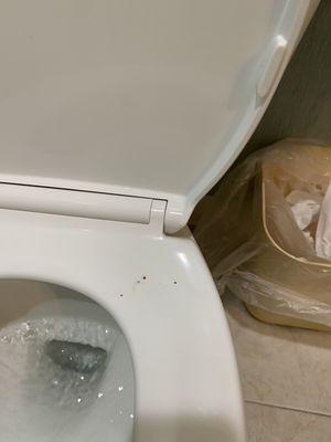 Fecal matter on toilet at Queen Anne Hotel in New Orleans