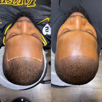 Westcoast Scalp Micropigmentation