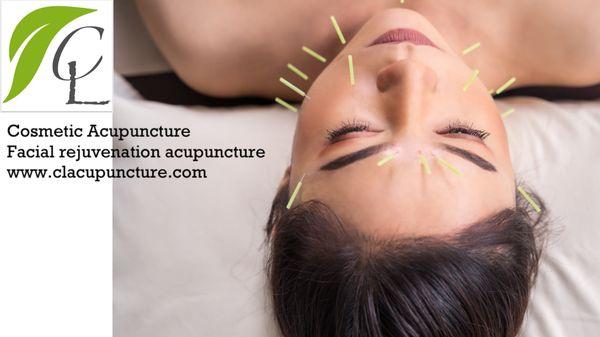 Facial rejuvenation Acupuncture