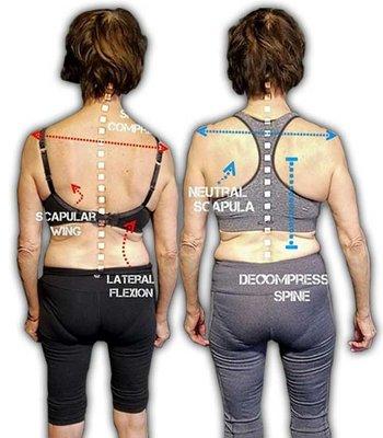 lets use massage and some active training to correct your posture!