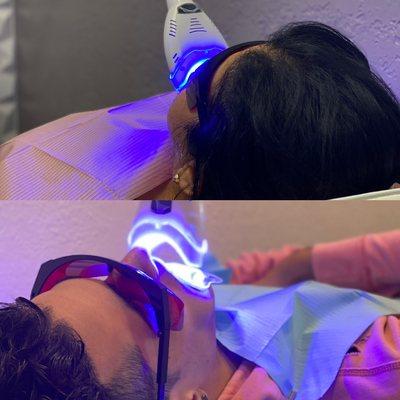 Teeth Whitening