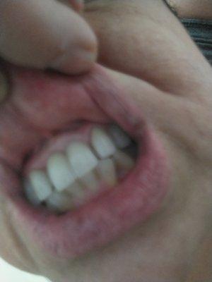 My teeth