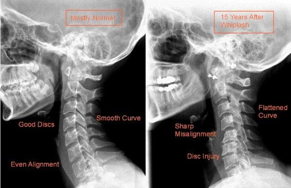 X-rays can show a lot