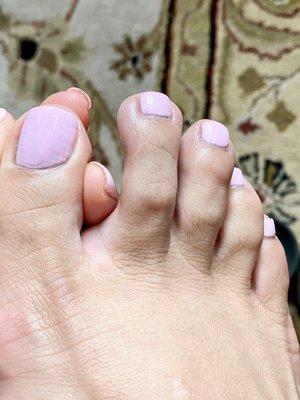 Toe nails