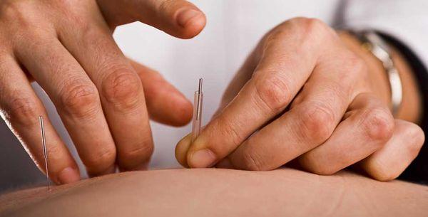 ACA Acupuncture & Wellness - Union Square