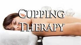 We offer Cupping - Call today for your appointment 843-725-8312