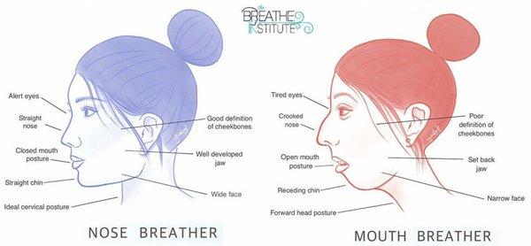 open mouth breathing can cause facial anatomy changes and poor health. Myo can help!