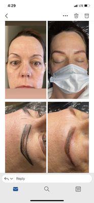 Fine Lines Dermal Services