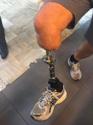 Ossteointegration Prostheses