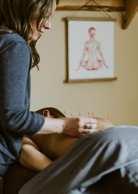 Rooting Wellness Acupuncture