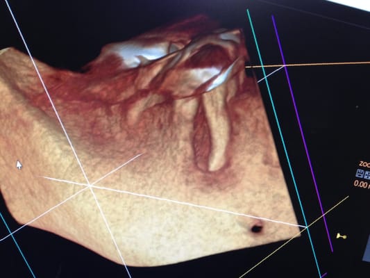 cone beam 3D technology which makes diagnosis and treatment more concise