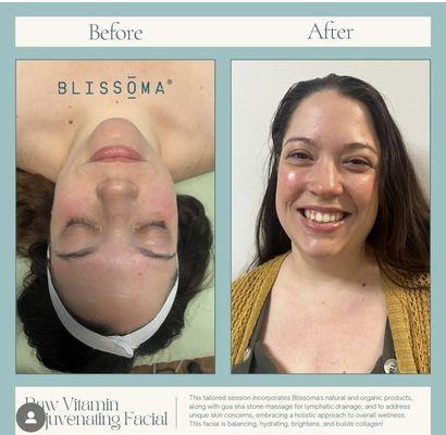 Raw Vitamin Rejuvenating Facial by Blissoma