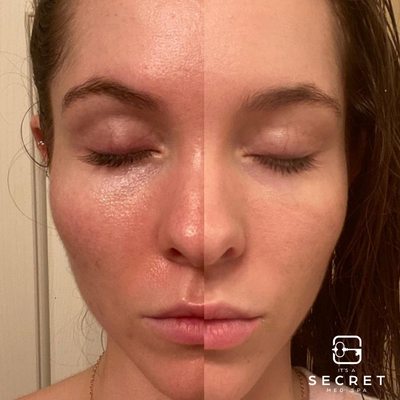 Skinbetter Even Tone Correcting Serum