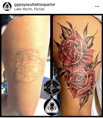 Super cool cover up of this scar, by Roger Pearson